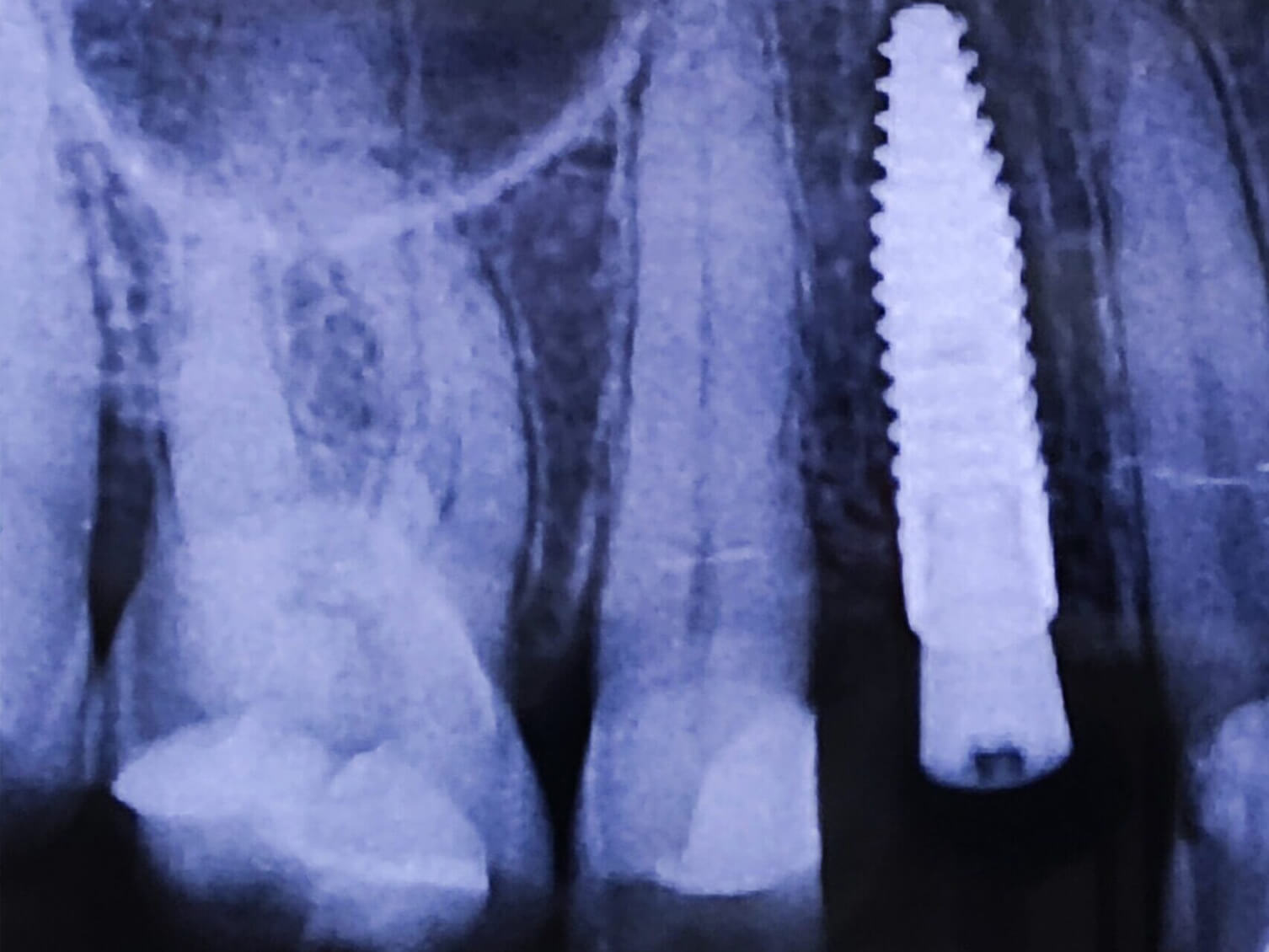 Dental Implant Mentoring image 1