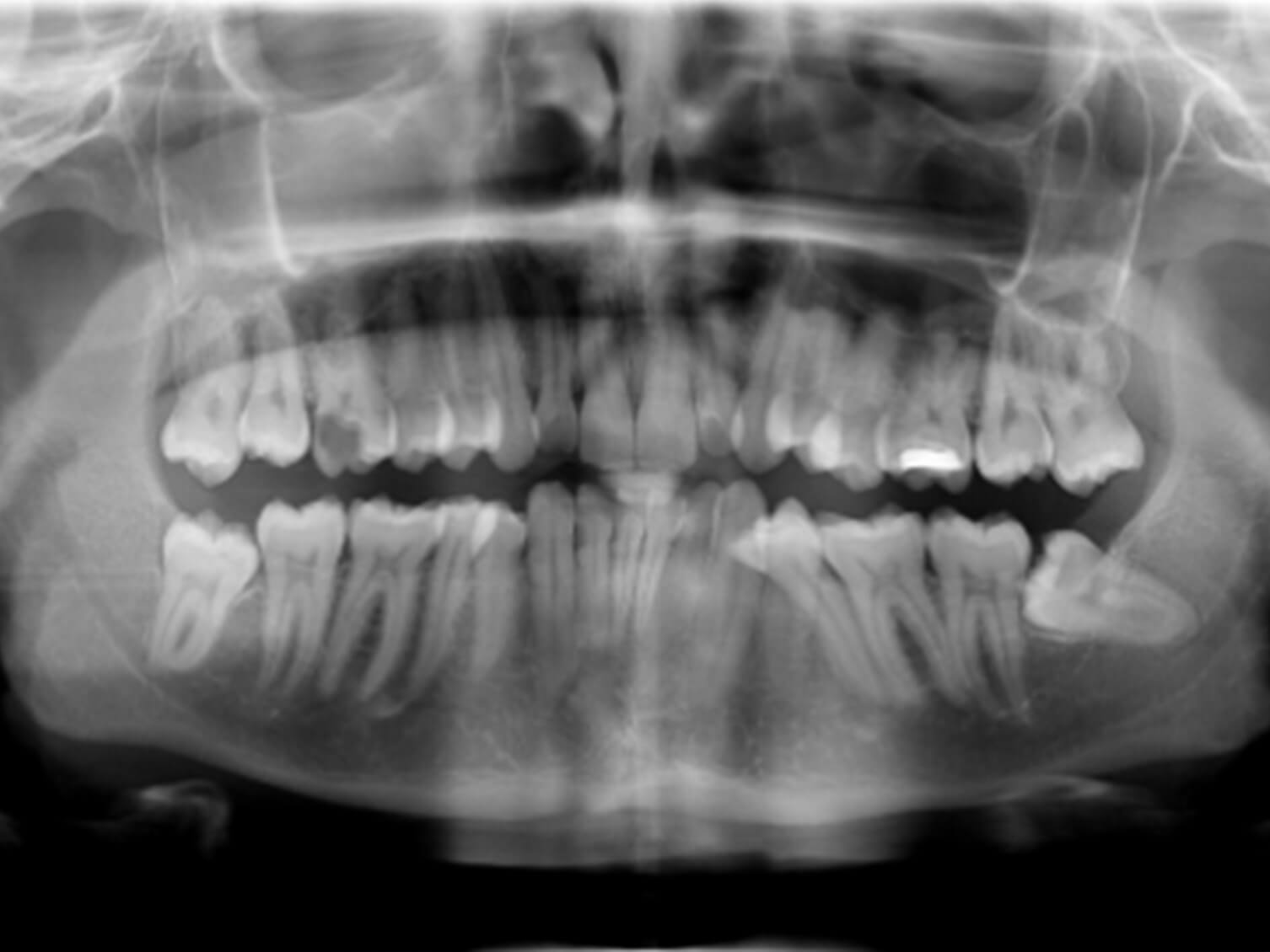Dental Implant Mentoring image 3